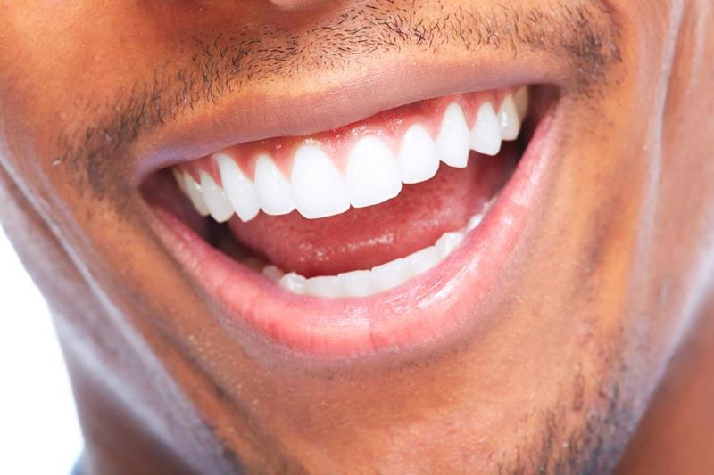 Fillings in Richardson, TX